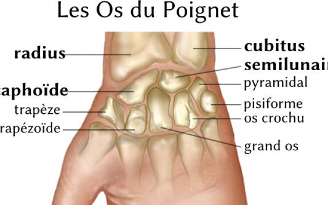 Arthrose du poignet – Le Centre Chirurgical De L'ARTHROSE